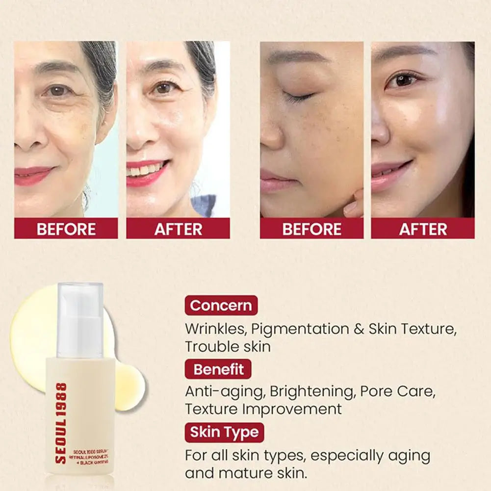 SEOUL 1988 Vitamin C Brightening Serum - Hyaluronic Acid Face Moisturizer